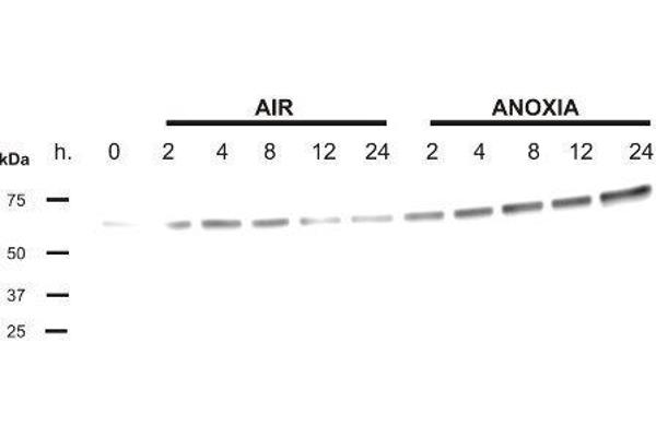 anti-Phosducin (PDC) antibody