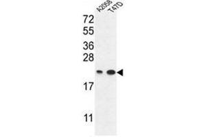 Image no. 1 for anti-Abhydrolase Domain Containing 14B (ABHD14B) (C-Term) antibody (ABIN950212)
