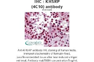 Image no. 2 for anti-KH-Type Splicing Regulatory Protein (KHSRP) (AA 151-240) antibody (ABIN1723541)
