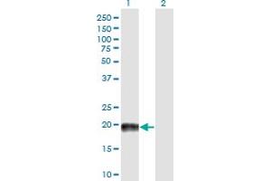 Western Blot analysis of MAP4 expression in transfected 293T cell line by MAP4 monoclonal antibody (M03), clone 7C9.