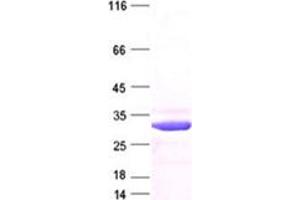 Image no. 1 for Cyclin-Dependent Kinase Inhibitor 1B (p27, Kip1) (CDKN1B) protein (DYKDDDDK Tag) (ABIN2713877)