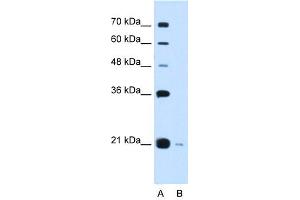 Image no. 1 for anti-DCTP Pyrophosphatase 1 (DCTPP1) (Middle Region) antibody (ABIN632345)