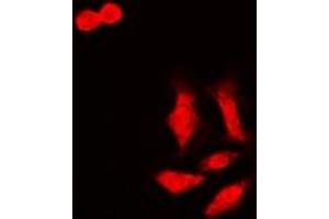 Image no. 2 for anti-LETM1 Domain Containing 1 (LETMD1) (full length) antibody (ABIN6004988)