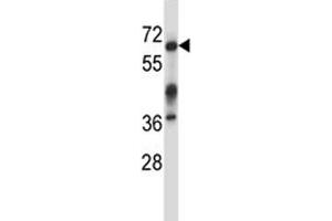 Image no. 2 for anti-Interleukin-1 Receptor-Associated Kinase 3 (IRAK3) (AA 517-544) antibody (ABIN3028766)
