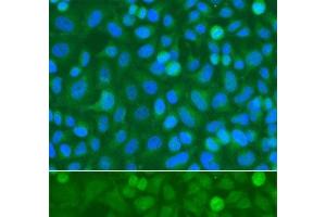 Immunofluorescence analysis of A549 cells using NCK1 Polyclonal Antibody