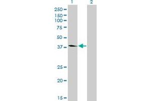 Western Blot analysis of FLJ23356 expression in transfected 293T cell line by FLJ23356 monoclonal antibody (M03), clone 6F10.