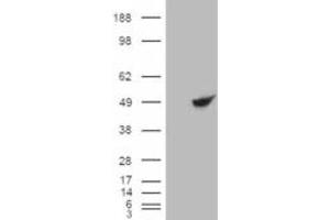 Image no. 2 for anti-Betaine--Homocysteine S-Methyltransferase (BHMT) (C-Term) antibody (ABIN334358)