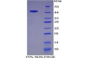 Image no. 1 for Chromogranin B (Secretogranin 1) (CHGB) protein (ABIN3008786)