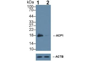 Image no. 2 for anti-Acid Phosphatase 1, Soluble (ACP1) (AA 1-158) antibody (ABIN1077731)
