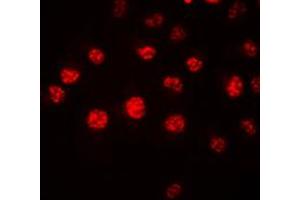 Image no. 1 for anti-Homeobox A1 (HOXA1) (Center) antibody (ABIN2706325)