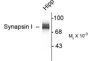 Image no. 1 for anti-Synapsin I (SYN1) antibody (ABIN361409)