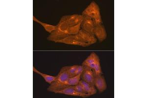 Retinoic Acid Receptor alpha anticorps  (AA 1-457)