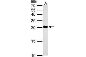 Image no. 5 for anti-NADH Dehydrogenase (Ubiquinone) Flavoprotein 2, 24kDa (NDUFV2) (Center) antibody (ABIN2855340)