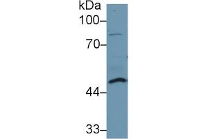Image no. 2 for anti-Dolichyl-diphosphooligosaccharide--Protein Glycosyltransferase (DDOST) (AA 43-427) antibody (ABIN1077976)