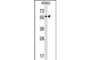 RARB Antibody (Center) (ABIN1537931 and ABIN2849656) western blot analysis in K562 cell line lysates (35 μg/lane).