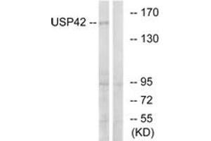 Image no. 1 for anti-Ubiquitin Specific Peptidase 42 (USP42) (AA 251-300) antibody (ABIN1535438)