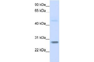 Image no. 1 for anti-F-Box Protein 25 (FBXO25) (N-Term) antibody (ABIN2774695)