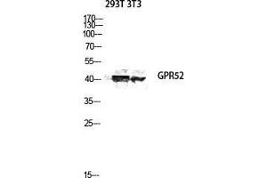 Image no. 2 for anti-G Protein-Coupled Receptor 52 (GPR52) (C-Term) antibody (ABIN3184904)