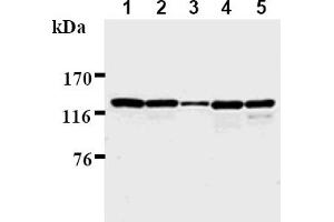 Image no. 1 for anti-Polymerase (DNA Directed), delta 1, Catalytic Subunit 125kDa (POLD1) antibody (ABIN567776)