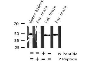 Image no. 4 for anti-Activating Transcription Factor 2 (ATF2) (pThr55), (pThr73) antibody (ABIN6255708)