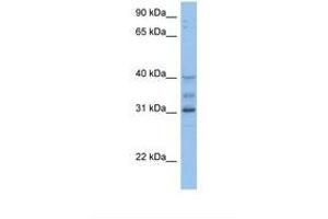 Image no. 1 for anti-Homeobox D1 (HOXD1) (AA 254-303) antibody (ABIN6737882)