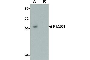 Image no. 1 for anti-Protein Inhibitor of Activated STAT, 1 (PIAS1) (C-Term) antibody (ABIN6656300)