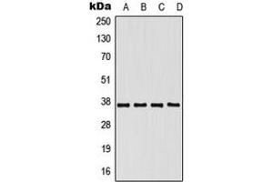 Image no. 1 for anti-Poly(rC) Binding Protein 1 (PCBP1) (N-Term) antibody (ABIN2707578)