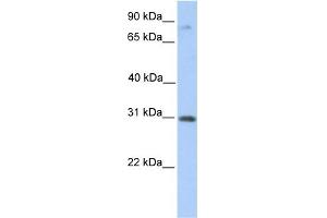 Image no. 1 for anti-Abhydrolase Domain Containing 13 (ABHD13) (C-Term) antibody (ABIN2784068)