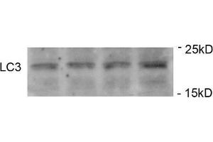 Image no. 4 for anti-Microtubule-Associated Protein 1 Light Chain 3 alpha (MAP1LC3A) (AA 1-30), (N-Term), (pSer12) antibody (ABIN1449623)