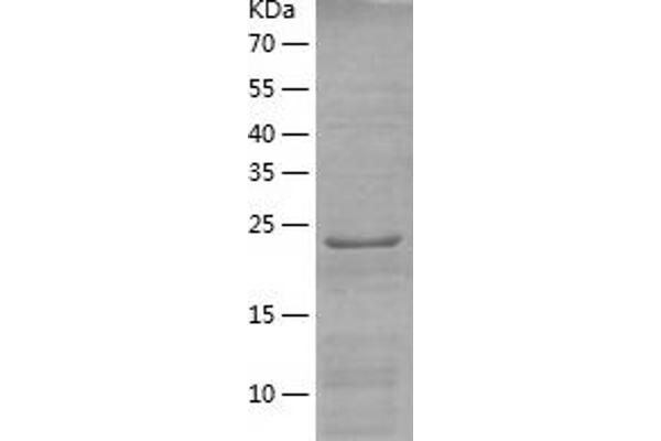 RAB34 Protein (AA 1-259) (His tag)
