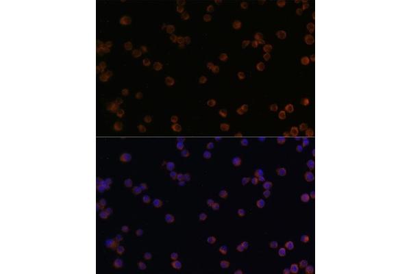 CHI3L1 antibody  (AA 22-240)