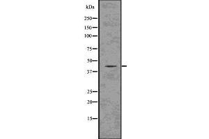 Image no. 3 for anti-Glutamine Synthetase (GLN1) antibody (ABIN6261999)
