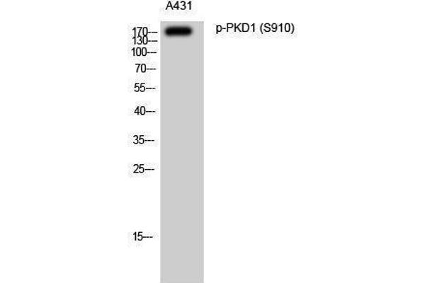 anti-Polycystic Kidney Disease 1 (Autosomal Dominant) (PKD1) (pSer910) antibody