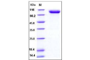 Image no. 1 for Plasminogen Activator, Urokinase Receptor (PLAUR) (AA 1-297), (Extracellular Domain) (Active) protein (Fc Tag,His tag) (ABIN2007425)