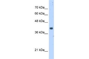 anti-Prenyl (Decaprenyl) Diphosphate Synthase, Subunit 1 (PDSS1) (Middle Region) antibody
