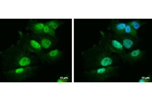 Image no. 1 for anti-Pre-B-Cell Leukemia Homeobox Protein 1 (PBX1) (Center) antibody (ABIN2856072)