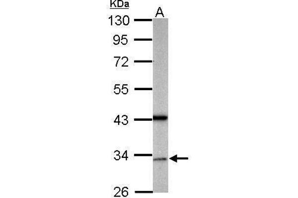 anti-Growth Arrest-Specific 2 Like 1 (GAS2L1) (Center) antibody