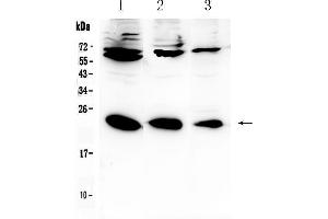 Image no. 1 for anti-Interleukin 2 (IL2) (AA 21-153) antibody (ABIN5518852)