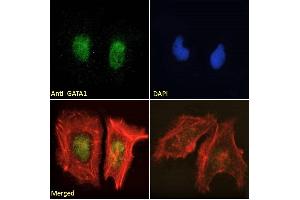 Image no. 5 for anti-GATA Binding Protein 1 (Globin Transcription Factor 1) (GATA1) (Internal Region) antibody (ABIN185449)