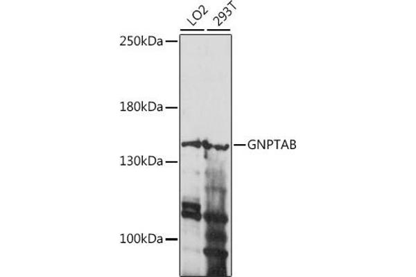 GNPTAB Antikörper  (AA 42-350)
