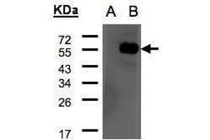 WB Image Western Blot analysis of ARHGAP1 expression in transfected 293T cell line by ARHGAP1 polyclonal antibody.