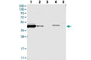 Image no. 1 for anti-Family with Sequence Similarity 54, Member A (FAM54A) antibody (ABIN5577847)