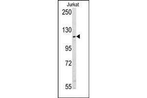 Image no. 2 for anti-Ubiquitin Specific Peptidase 11 (USP11) (N-Term) antibody (ABIN357538)