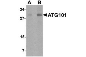 ATG101 antibody  (Center)