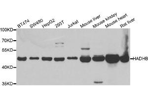 Image no. 1 for anti-Hydroxyacyl-CoA Dehydrogenase/3-Ketoacyl-CoA Thiolase/enoyl-CoA Hydratase (Trifunctional Protein), beta Subunit (HADHB) antibody (ABIN2562992)