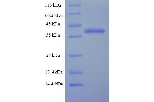 Image no. 1 for Charged Multivesicular Body Protein 5 (CHMP5) (AA 1-219), (full length) protein (His-SUMO Tag) (ABIN5711871)