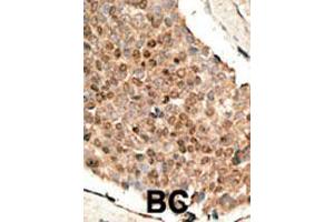 Image no. 1 for anti-Bone Morphogenetic Protein 10 (BMP10) (AA 7-35), (N-Term) antibody (ABIN388448)