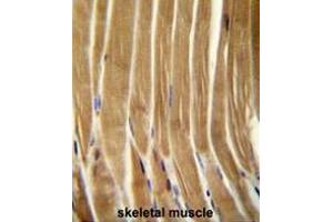 Image no. 1 for anti-Caspase 5, Apoptosis-Related Cysteine Peptidase (CASP5) (AA 146-175), (Middle Region) antibody (ABIN951054)