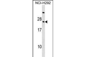 RARRES3 Antibody (Center) (ABIN1538411 and ABIN2850262) western blot analysis in NCI- cell line lysates (35 μg/lane).