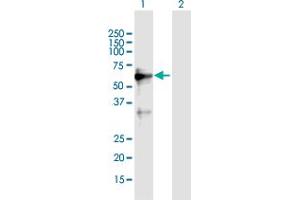 Image no. 1 for anti-Zinc Finger Protein 554 (ZNF554) (AA 1-538) antibody (ABIN1774869)